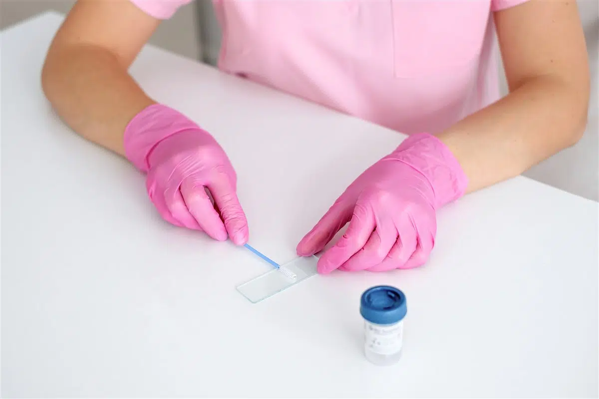 réalisation des frottis médicaux