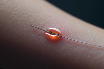 découvrez quoi faire si un fil résorbable reste sous la peau, les précautions à prendre et à quel moment consulter un professionnel de santé pour éviter les complications.